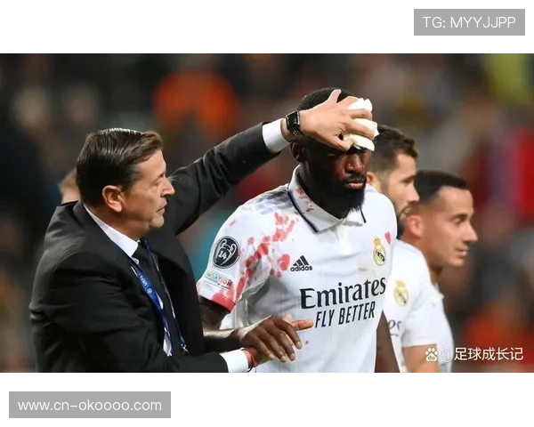 皇马后卫吕迪格伤缺，临时防线迎战术稳定性考验